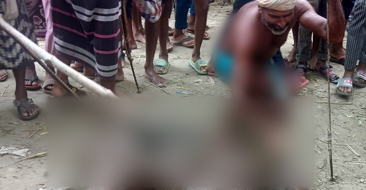 চাঁপাইনবাবগঞ্জে শূকরের কামড়ে আহত ৬