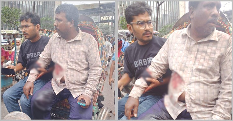 মতিঝিলে প্রকাশ্যে ব্যবসায়ীকে গুলি করে ১৭ হাজার ডলার লুট